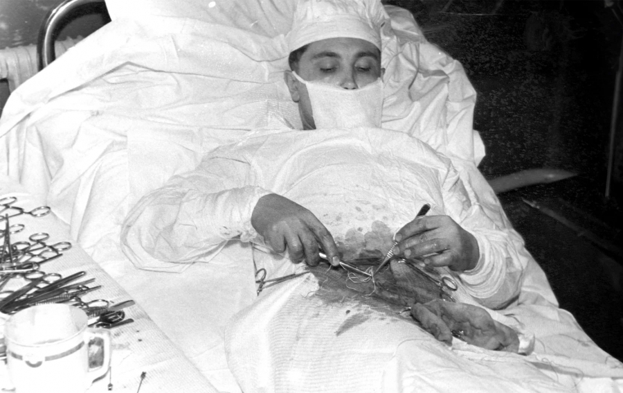 An image of a doctor operating the abdominal area on himself
