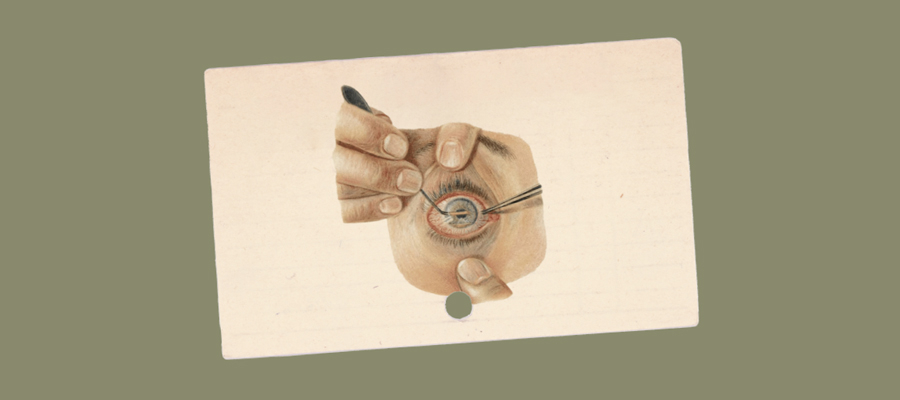 Color lithograph centering an eye being fingered open for surgery after a foreign body in the eye and successive infections